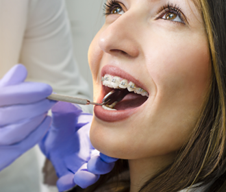 roots-dental-clinic-braces