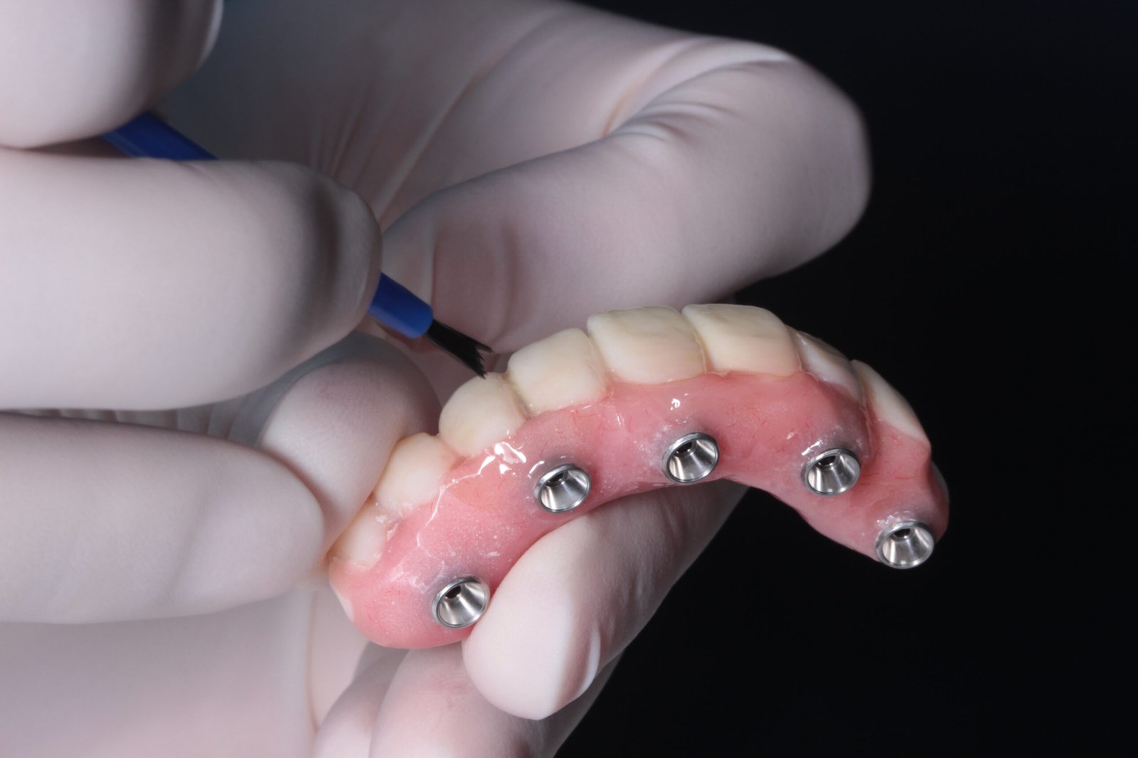 dentures