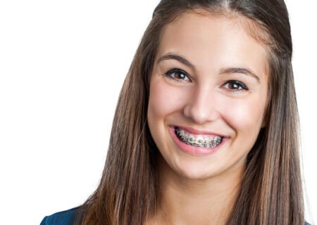 metal-braces