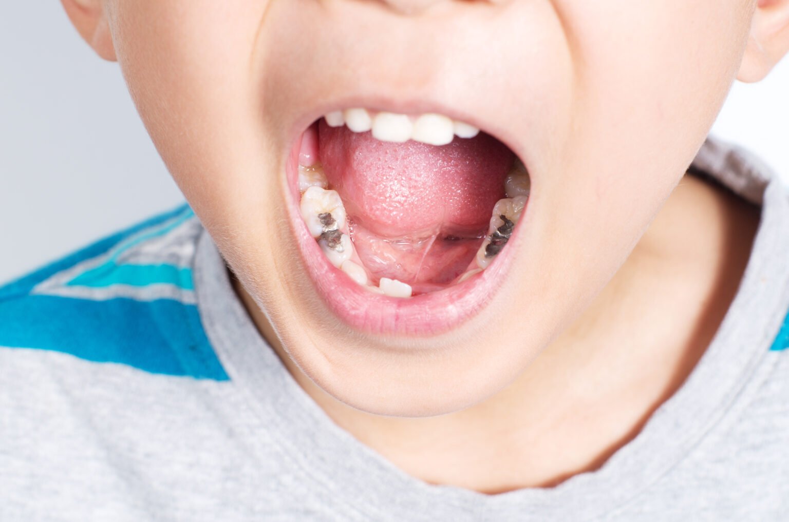 kids-dentistry