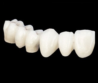 roots-wellness-clinic-bridges-crowns